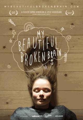 فيلم My Beautiful Broken Brain 2014 مترجم
